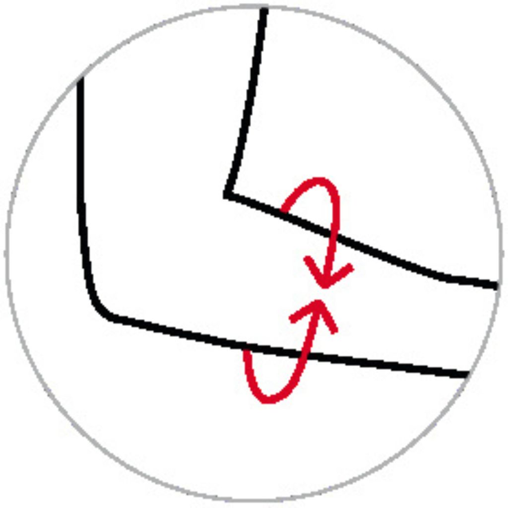 Vermessungspunkt Donjoy EpiForce Ellenbogenbandage